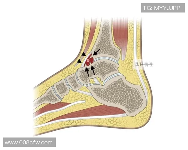足球踝关节手术后康复指南与注意事项详解